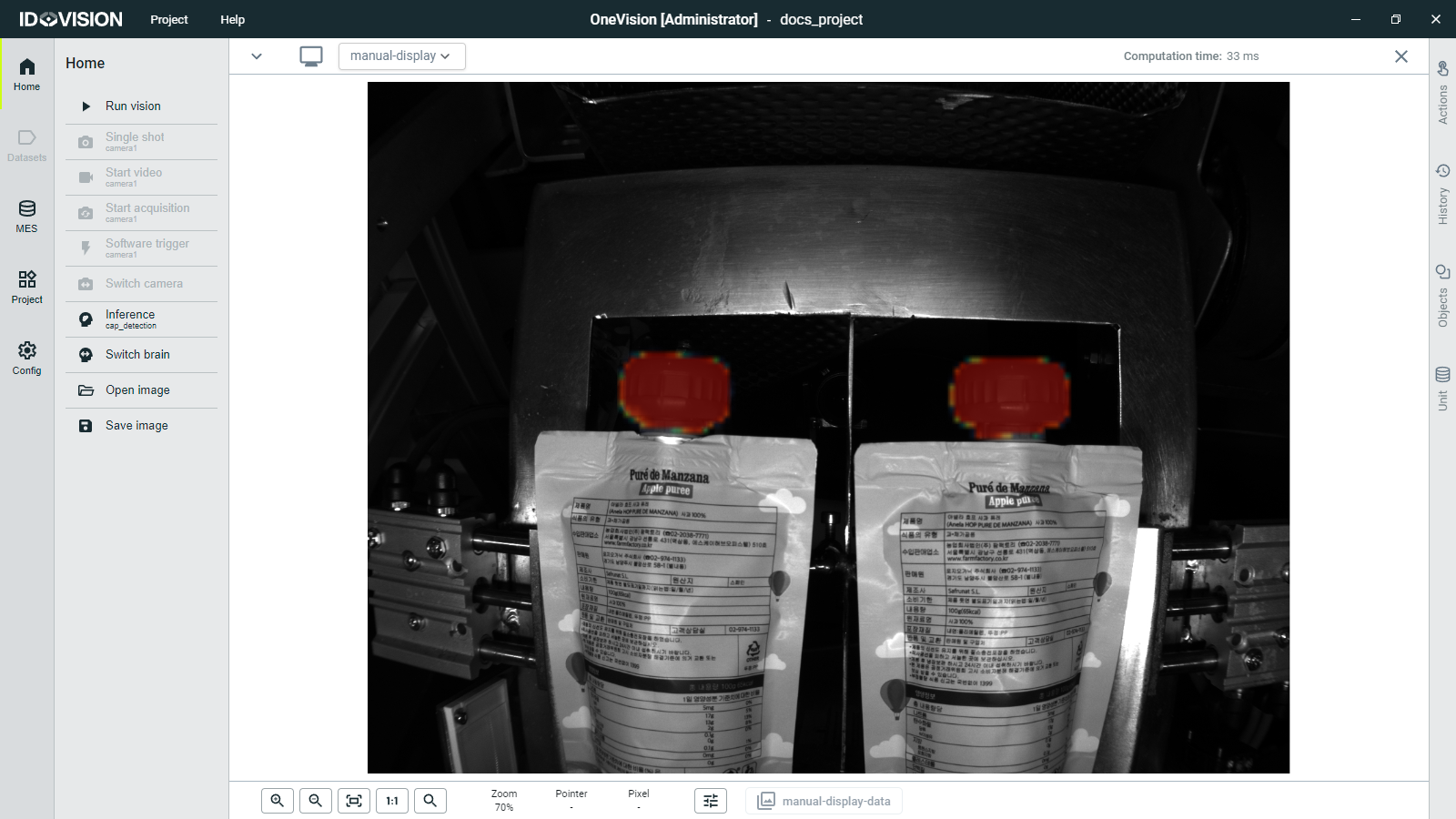 Manual brain inference